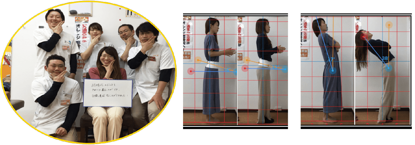 患者様の姿勢ビフォーアフターと寄せ書き写真