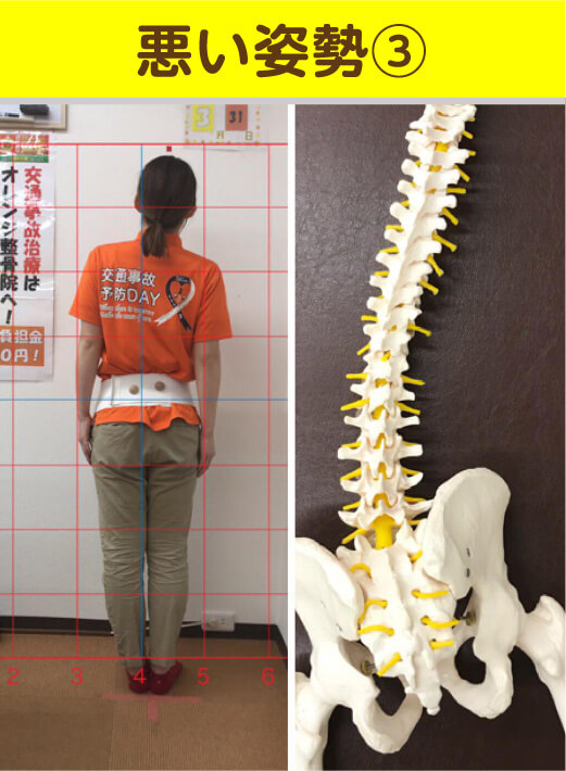 悪い姿勢3 姿勢と骨格模型の比較