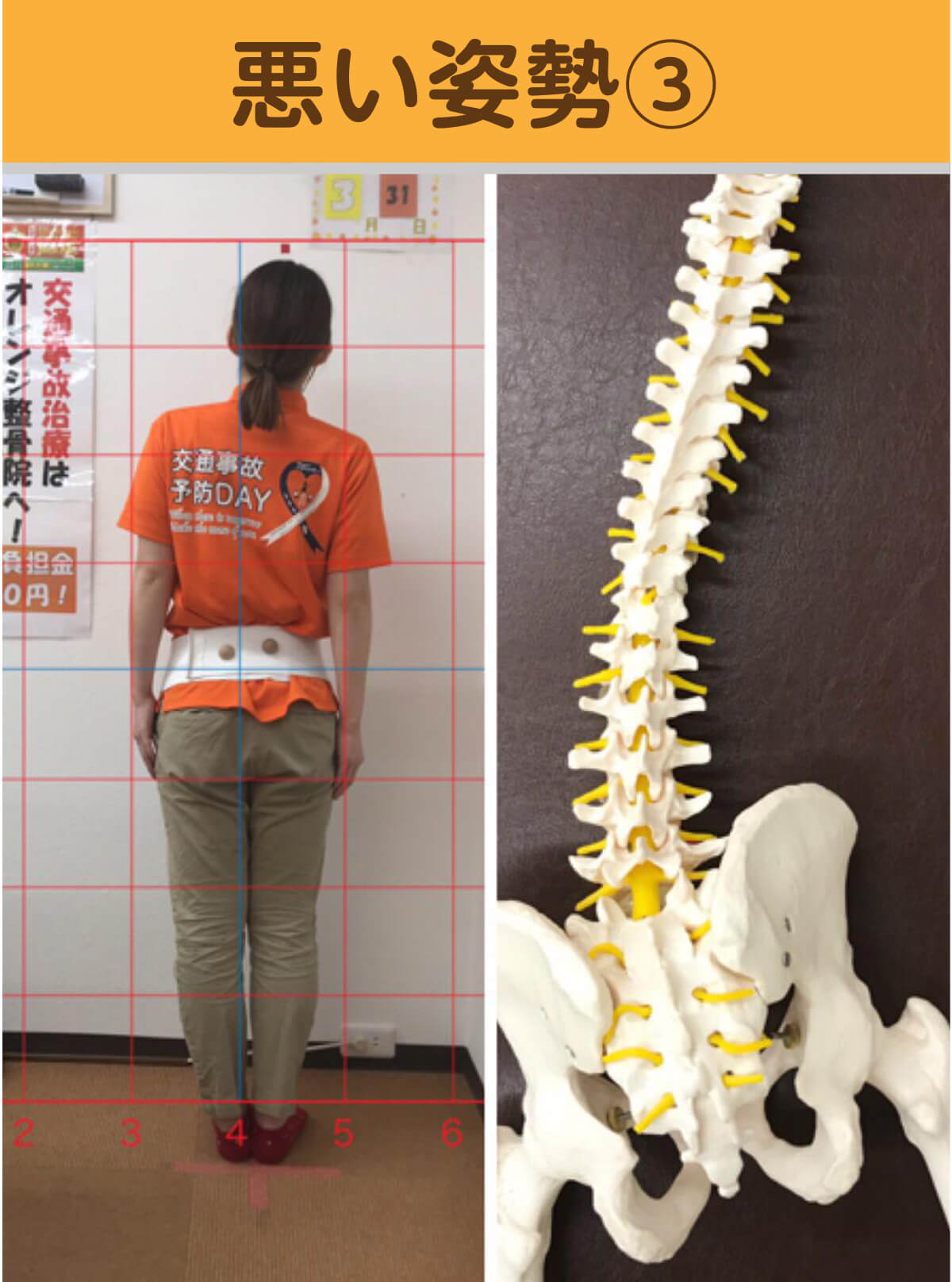 悪い姿勢3 姿勢と骨格模型の比較