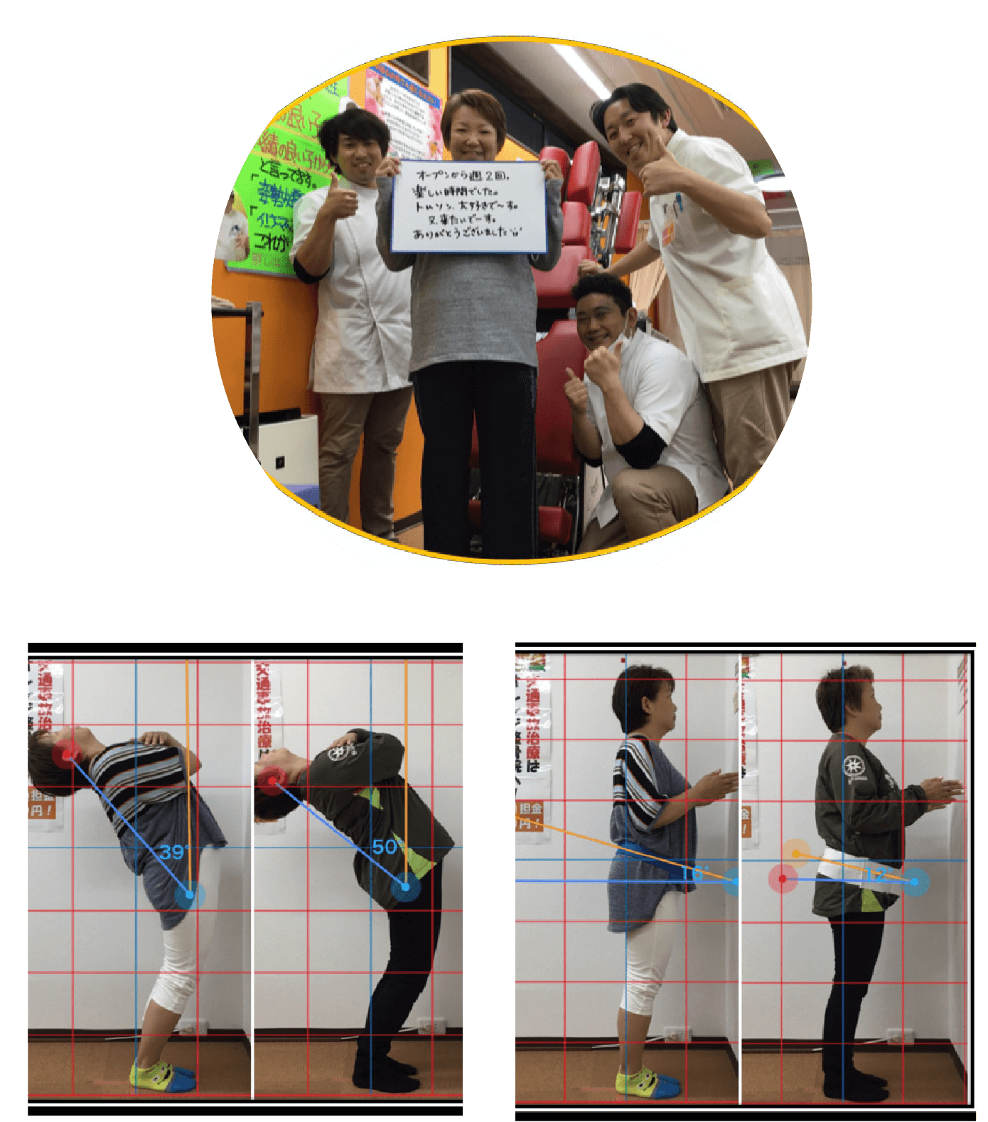 膝の痛みが改善した患者様の写真と姿勢ビフォーアフター