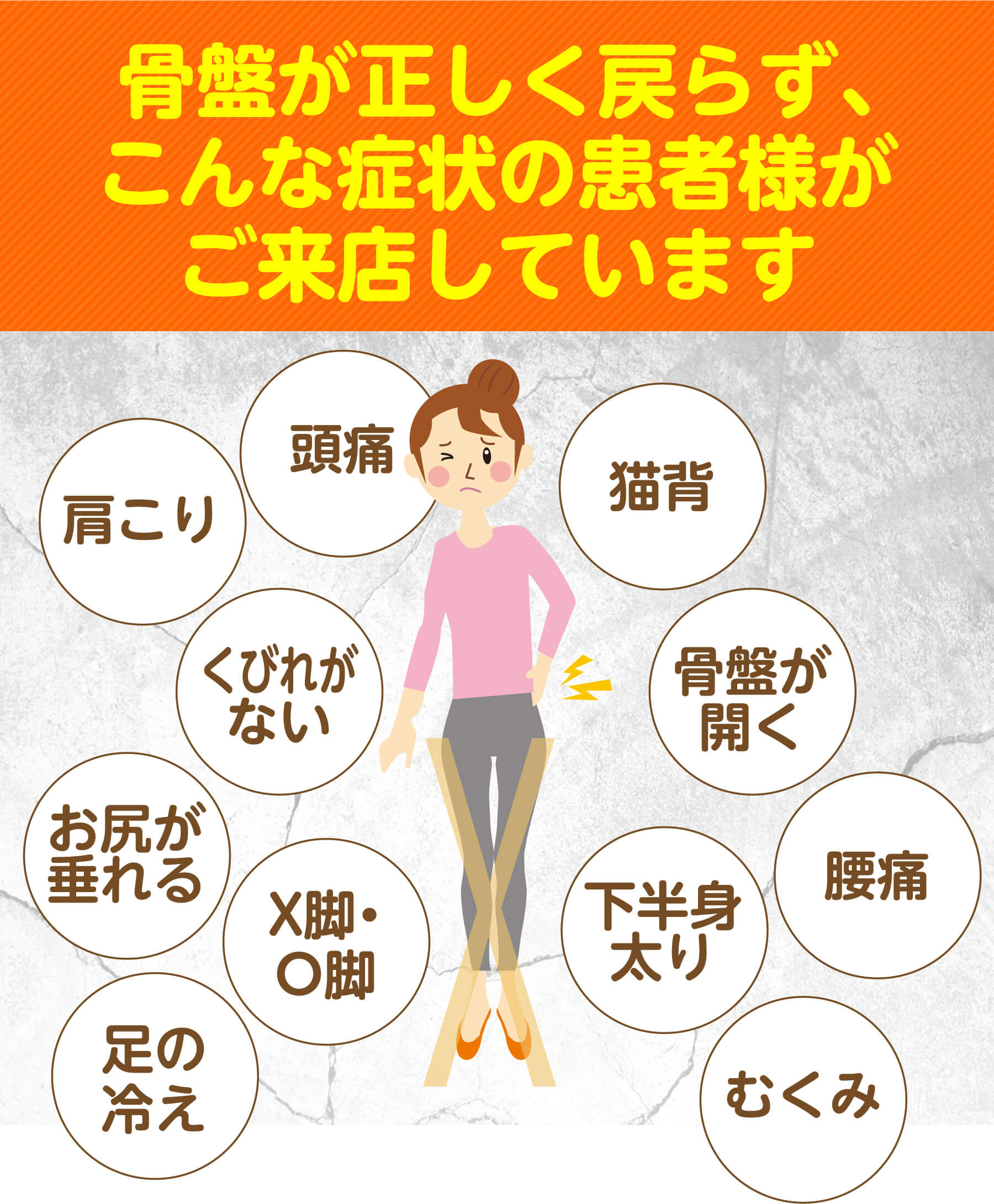 骨盤が正しく戻らず、こんな症状の患者様がご来店しています（頭痛・肩こり・猫背・くびれがない・骨盤が開く・お尻が垂れる・X脚O脚・下半身太り・腰痛・足の冷え・むくみ）