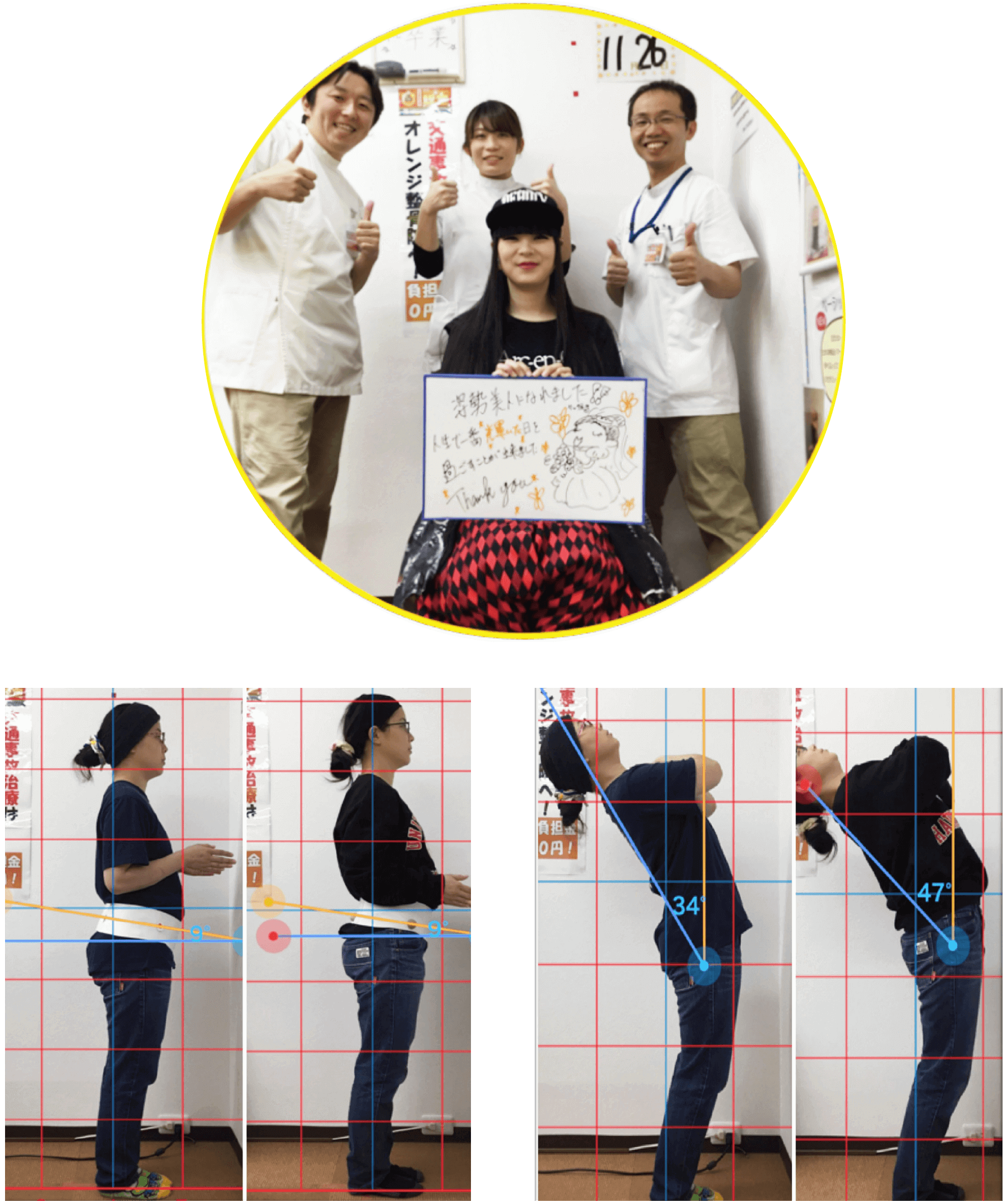 患者様の姿勢ビフォーアフターと寄せ書き写真