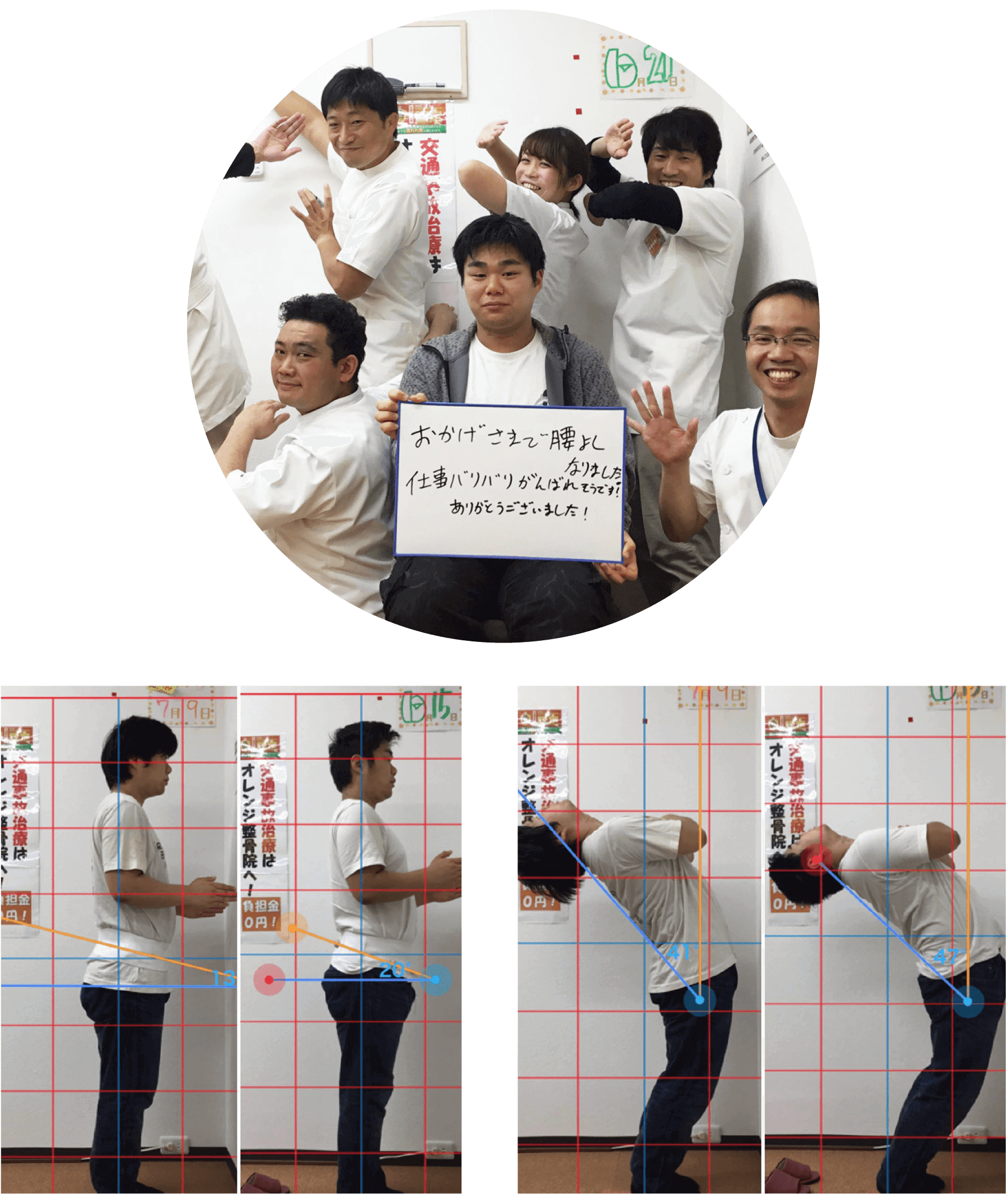 腰痛が改善した患者様の写真と姿勢ビフォーアフター